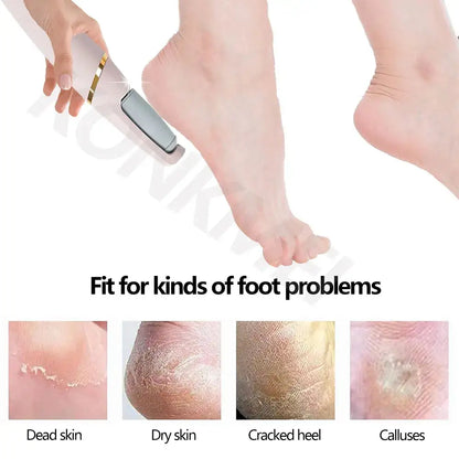 Ultimate Foot Exfoliator – Smooth, Soft & Rejuvenated Feet!